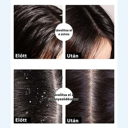 Nanmeishun ginzeng sampon előtte-utána hajápolási infografikán